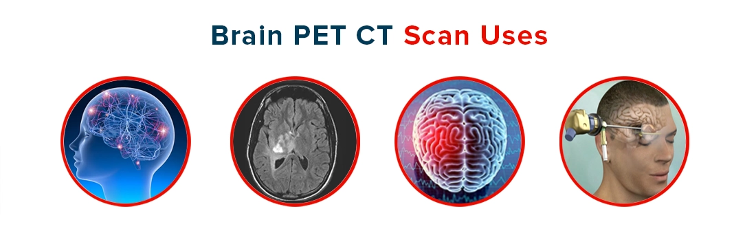 Brain PET CT Scan Uses